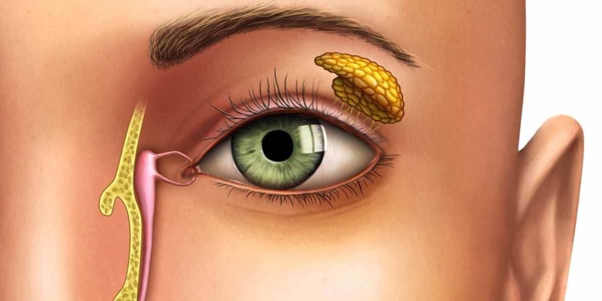 Tratamiento vías lagrimales Yag Ocular